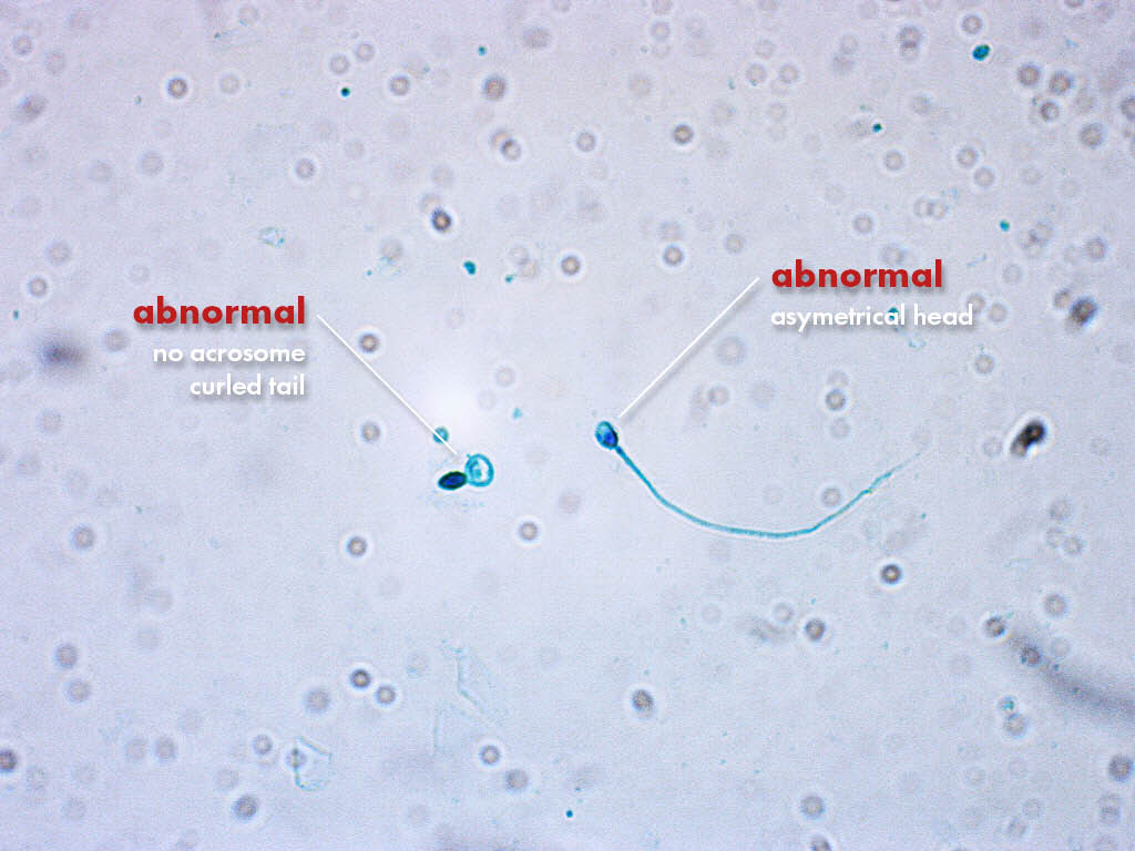 FertiPro: Spermac Stain interpretation of the results