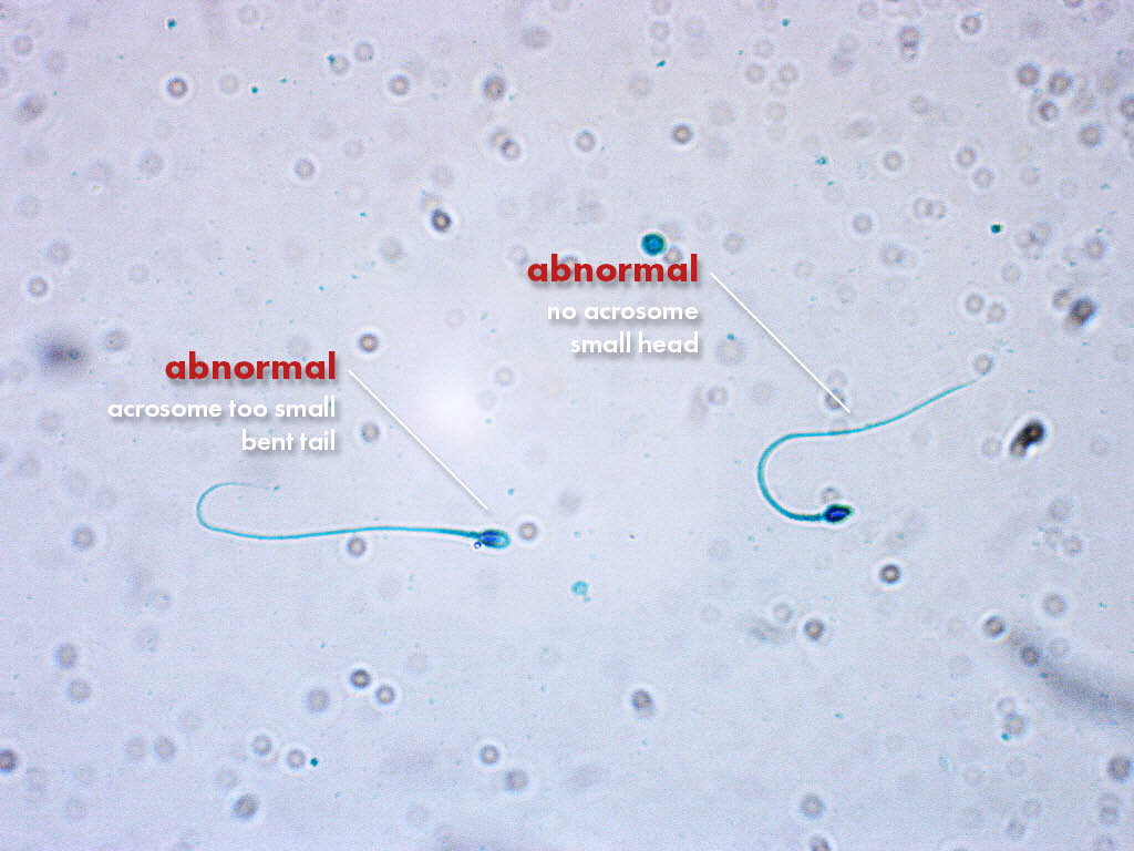 FertiPro: Spermac Stain interpretation of the results