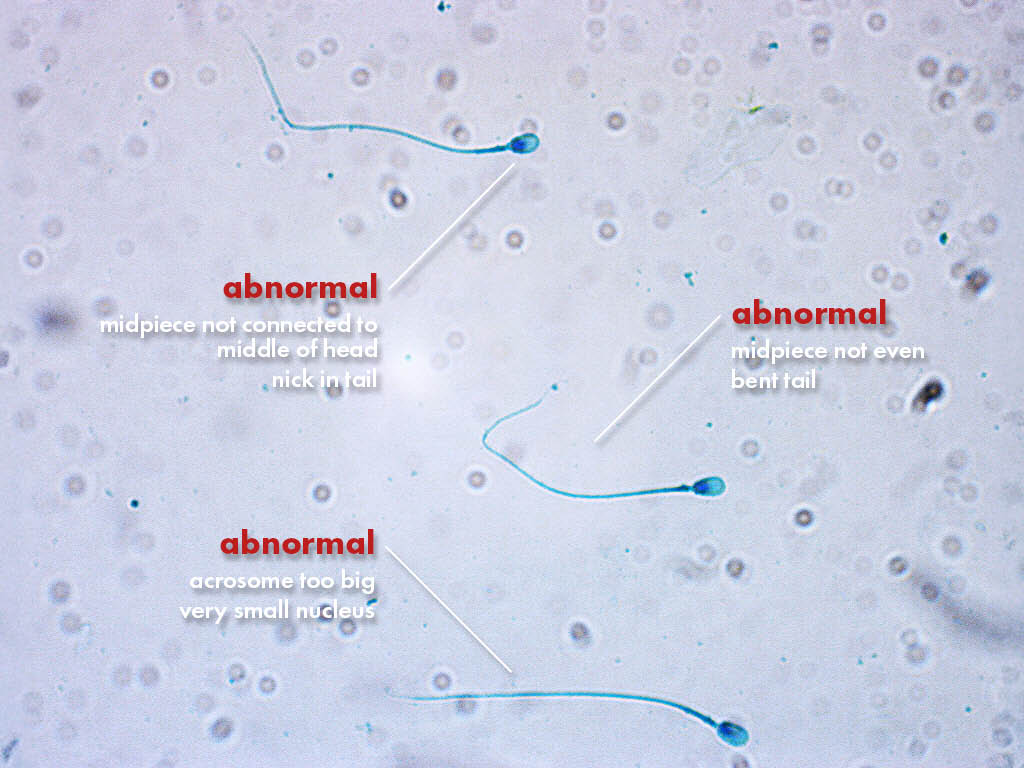 FertiPro: Spermac Stain interpretation of the results