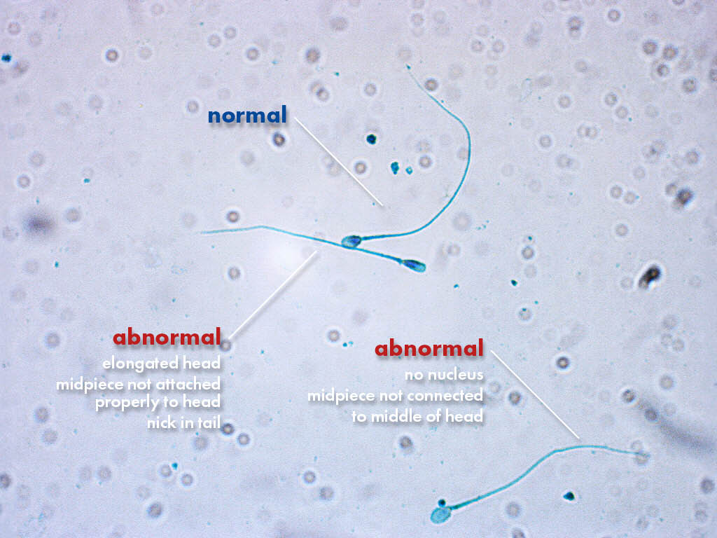 FertiPro: Spermac Stain interpretation of the results