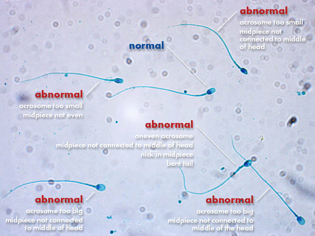 FertiPro: Spermac Stain interpretation of the results