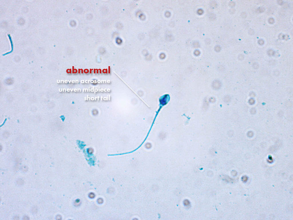 FertiPro: Spermac Stain interpretation of the results