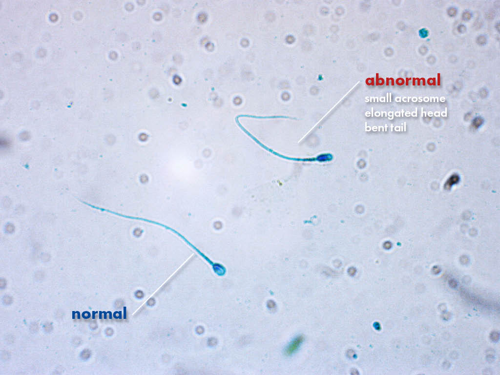 FertiPro: Spermac Stain interpretation of the results