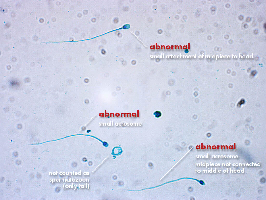 FertiPro: Spermac Stain interpretation of the results
