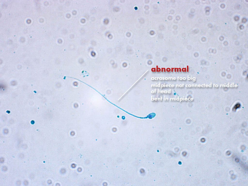 FertiPro: Spermac Stain interpretation of the results