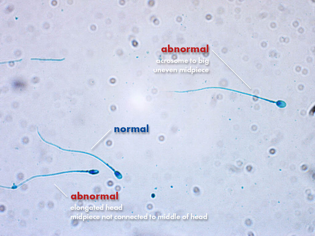 FertiPro: Spermac Stain interpretation of the results